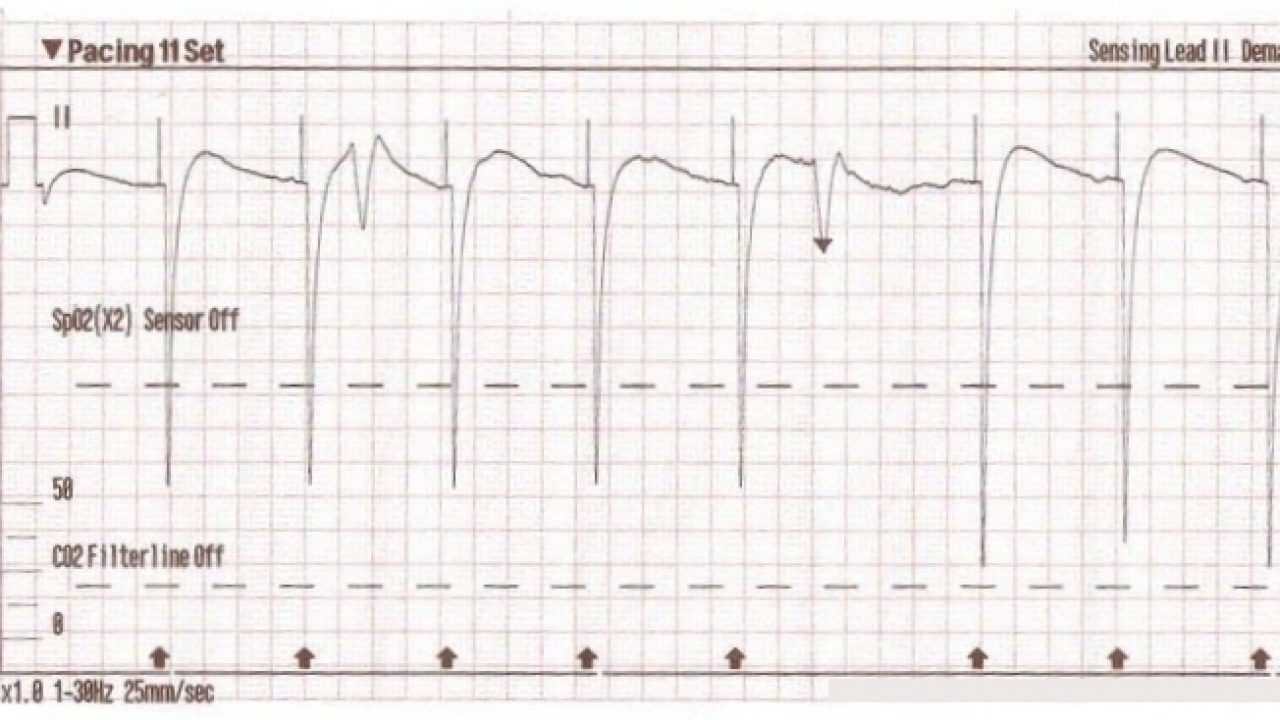 Running stats runners track pacing perfect wearable apps tech should feel case making runningmagazine ca